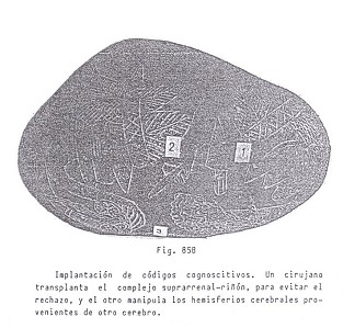 Fig. 85B: Implantacin de cdigos
                02