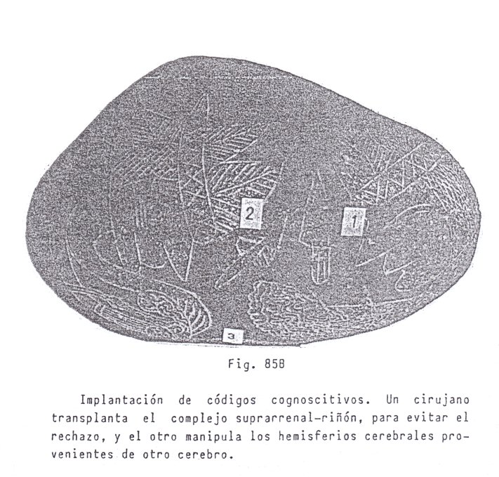 Fig.
                                85B: Implantacin de cdigos 02